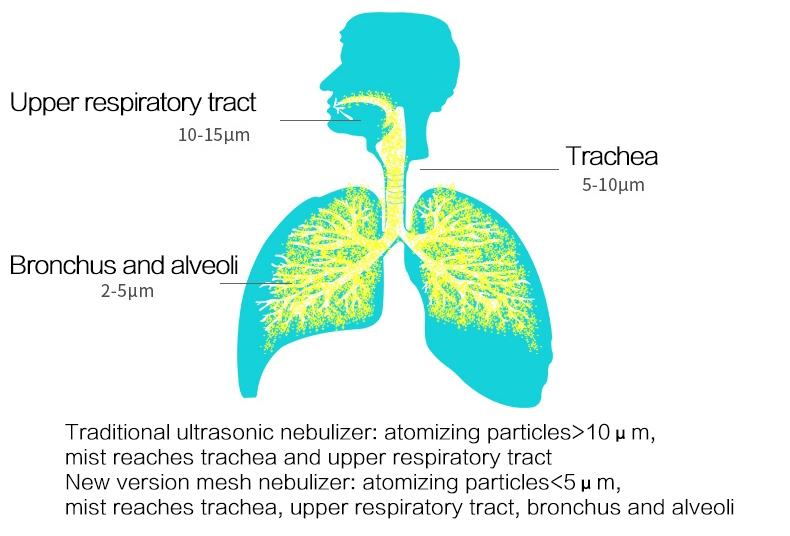 Yuwell-Mesh-M102-Asthma-Inhaler-Nebulizer-Children-Kids-Adult-Inhalator